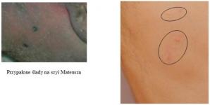 [VIDEO]: Nie wierzę w rzetelną sekcję zwłok Magdaleny Żuk we Wrocławiu, Krakowie ani nigdzie w Polsce. Nawet po ekshumacji mojego 19-letniego syna, zabitego paralizatorami, kręcą i mataczą! - alarmuje matka Agnieszka Leszczyńska