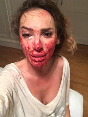 [VIDEO] Rutkowski ratuje „żony Konstancina”.  Ofiara przemocy Ewelina Ślotała zdecydowała się opowiedzieć o swoim dramacie