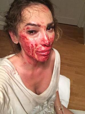 Nie żyje 35-letnia Ewelina Ślotała - autorka książek o kulisach życia w Konstancinie.  Krzysztof Rutkowski udzielił jej pomocy po brutalnym pobiciu w Hiszpanii