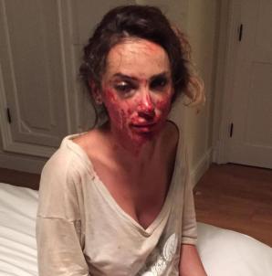 Nie żyje 35-letnia Ewelina Ślotała - autorka książek o kulisach życia w Konstancinie.  Krzysztof Rutkowski udzielił jej pomocy po brutalnym pobiciu w Hiszpanii