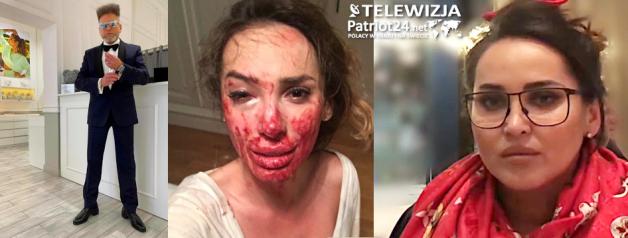 [VIDEO] Rutkowski ratuje „żony Konstancina”.  Ofiara przemocy Ewelina Ślotała zdecydowała się opowiedzieć o swoim dramacie